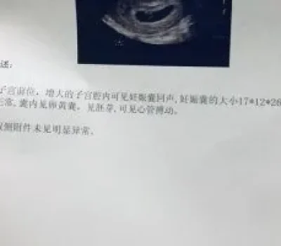 37岁做试管别只看成功率广告，真正要盯紧的是胚胎质量和活产数据