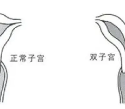 别把三代试管当成包健康，PGT是风险管理不是天才宝宝筛选器