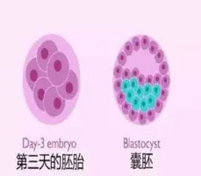 别被日本三代成功率带跑偏，试管选技术先看3个关键指标