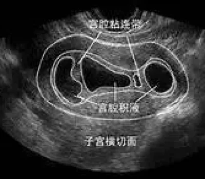 别被高成功率带节奏，做辅助生殖先查资质再算清费用