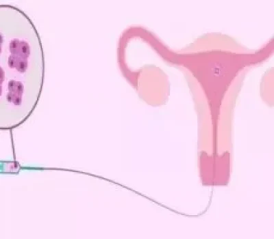 包生男孩的试管承诺，卖的不是医学方案而是高价焦虑