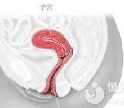 地贫三代试管六万元只是入场券，报价单这几项不问清容易越花越多