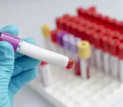 蚕豆病不是做三代就能避开，先查清G6PD变异和机构资质