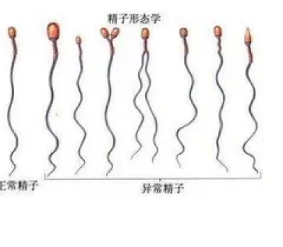 二代三代试管不是高低配别被更贵更保险的话术带偏