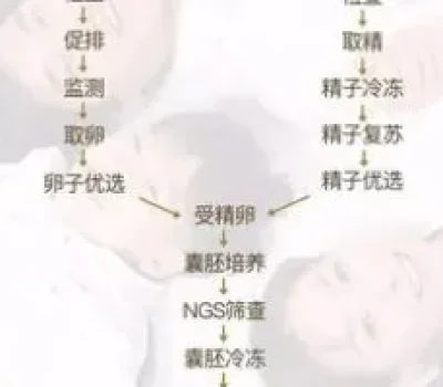 格鲁吉亚三代试管套餐看似一价全包，真正烧钱的是那些另算的费用