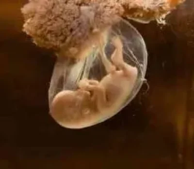 三代试管成功率不是通关密码，先问清这几个数字怎么算