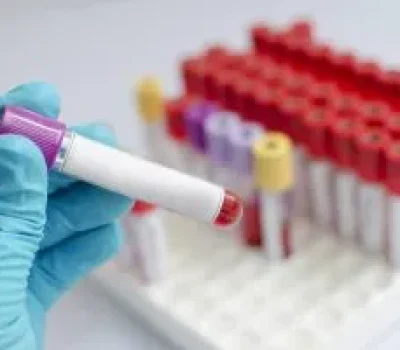 三代试管拿到全包价就放心？检测和重复周期才是隐形账单