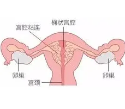 三代试管全包不等于全覆盖，签字前先问清这6笔费用