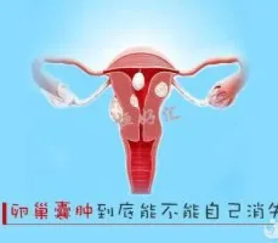 三代试管全包价不等于怀上为止，签字前先问清哪些钱能退