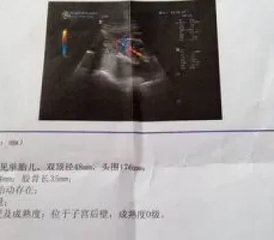 三代试管最贵的坑不是技术而是包成功承诺