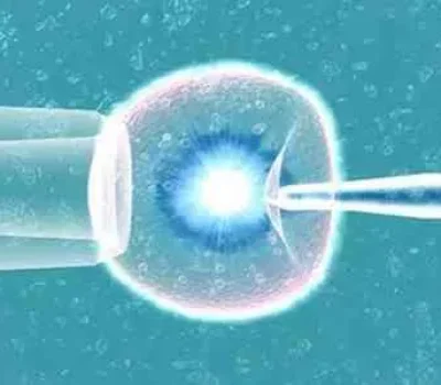 最贵的试管婴儿不是第三代而是没指征却花十几万做筛查