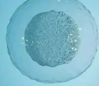移植后必须卧床是误区，胚胎不会因走动掉出，真正要盯紧用药和危险信号