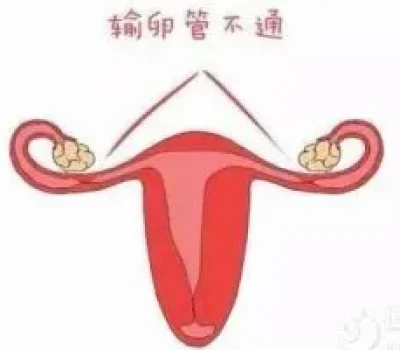 冷冻卵子不是生育保险柜，别被一个高成功率骗去交定金