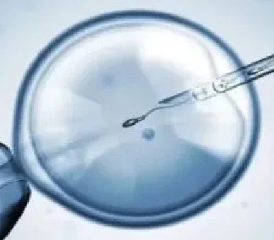 多囊做试管别被高成功率割韭菜，先看统计口径和个体方案