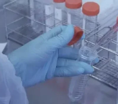 少精症做试管别只盯着数量，能否找到可用精子和优质胚胎才是关键