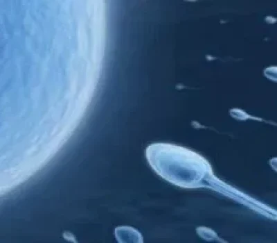 巧囊做试管别急着先切卵巢储备和手术利弊才是关键