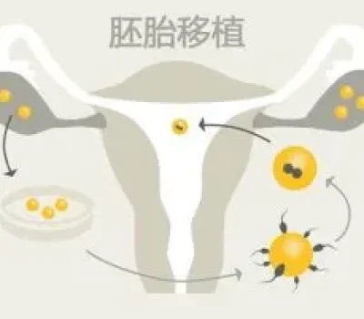试管别被医生个人成功率带偏，先问清这个百分比的分母是谁