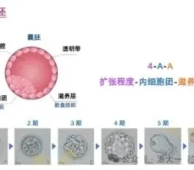 试管婴儿最残酷的真相是努力不等于成功真正要看这4道门槛