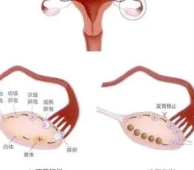 贝依会把内膜打坏吗？短暂变薄不等于不可逆损伤