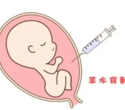 试管移植后爬楼会让胚胎掉出来吗？真正该防的是剧烈运动与盲目卧床