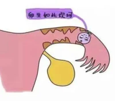 试管婴儿全包两万五靠谱吗真正贵的是被成功承诺牵着走