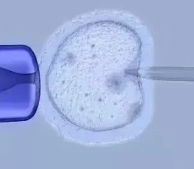 不孕抗体7项阳性就找到了病根吗，别让一张化验单替代完整生殖评估