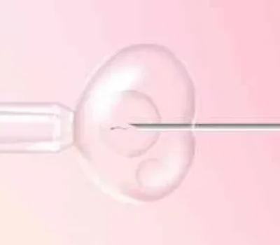 内膜薄不是失败判决，先查宫腔粘连息肉和炎症再决定移植