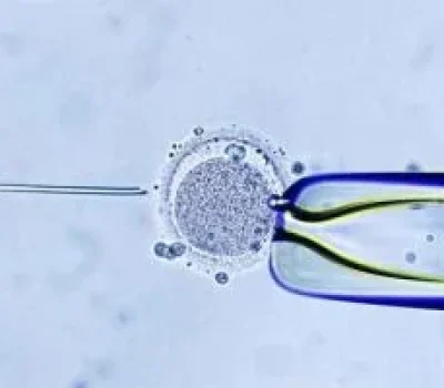 囊胚移植别把每个感觉当答案，着床要靠检查确认
