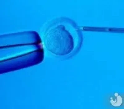 抗苗勒管激素数值高低不能判定能否怀孕，化验单只是评估卵巢储备的一块拼图