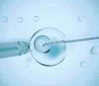 豆浆雪蛤油补不了雌激素，月经紊乱先查清真正原因