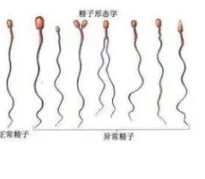 高龄做试管，胚胎多不等于更安稳，先查清夫妻双方风险