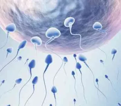 巧克力囊肿做试管一定要先手术吗，卵巢储备才是关键考量