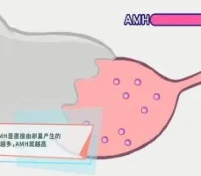试管婴儿不是忌口比赛，保健品和极端清淡都不能把成功率翻倍