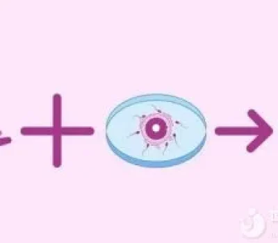 试管治疗中腹痛别硬扛，轻微可观察，持续加重须及时就医