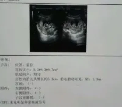 试管移植失败不是身体被掏空，先排查原因再决定是否重来