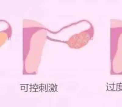 Rh阴性做试管能阻断溶血吗，关键在抗体筛查与胎儿监测