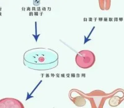 别把试管当失败者后路，夫妻先查清不孕卡在哪里