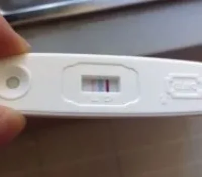 发现卵巢囊肿别急着切，也别盲目做三代试管