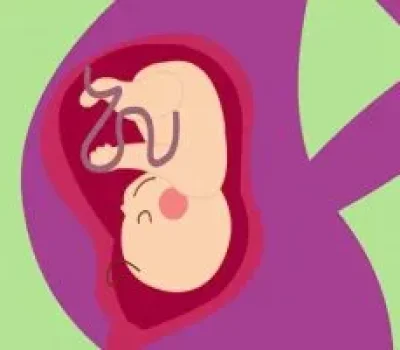备孕不是让妻子吃药，男人也要戒烟酒避高温并做精液检查