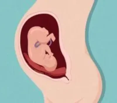 备孕别把强阳、抬腿和黑豆粉当秘诀，夫妻双方该检查就检查