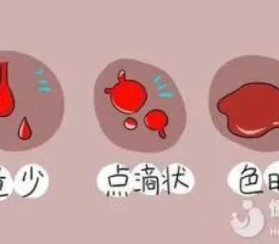 第三代试管成功率不是保证书，关键要看能否形成可移植胚胎