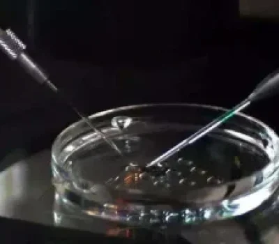 高龄二胎输卵管堵塞，别只想着疏通还要评估卵巢储备和胚胎机会