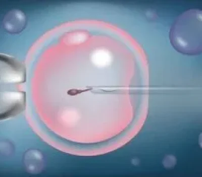宫腔镜不是试管前必做的入场券，哪些情况才值得做