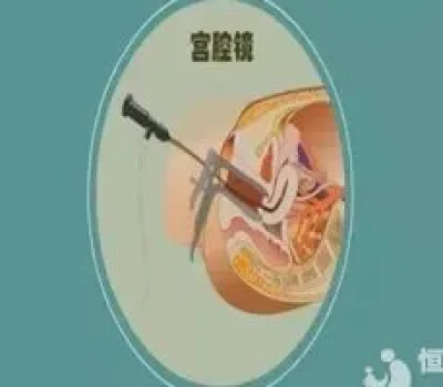 抗缪勒管激素数值高，试管婴儿成功率就一定高吗？