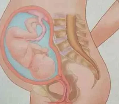 结扎后还能怀孕吗，复通还是试管该怎么选？