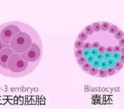 人工授精与验孕，试纸只是初筛，抽血确认才可靠
